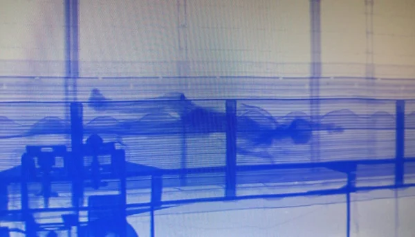 foto colorida mostra imagem de corpo detectado dentro de conteiner no Porto de Santos - Metropoles