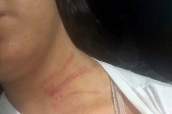 Jovem é torturada, estuprada e ameaçada de morte pelo ex-namorado