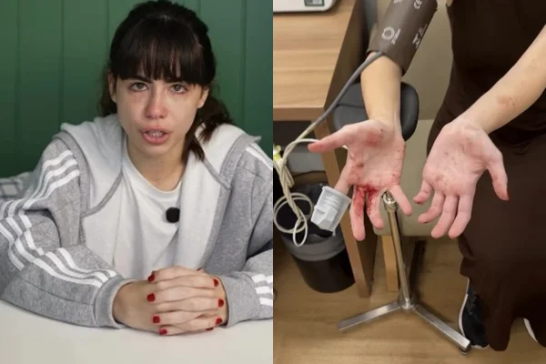 Vídeo: atriz mostra ferimentos após reagir a assalto em SP
