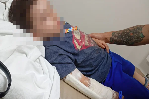 “Risco de necrosar”, diz mãe de menino autista que teve dedo decepado