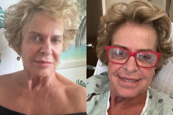 Ex-jornalista da TV Globo revela retirada de cisto e faz desabafo
