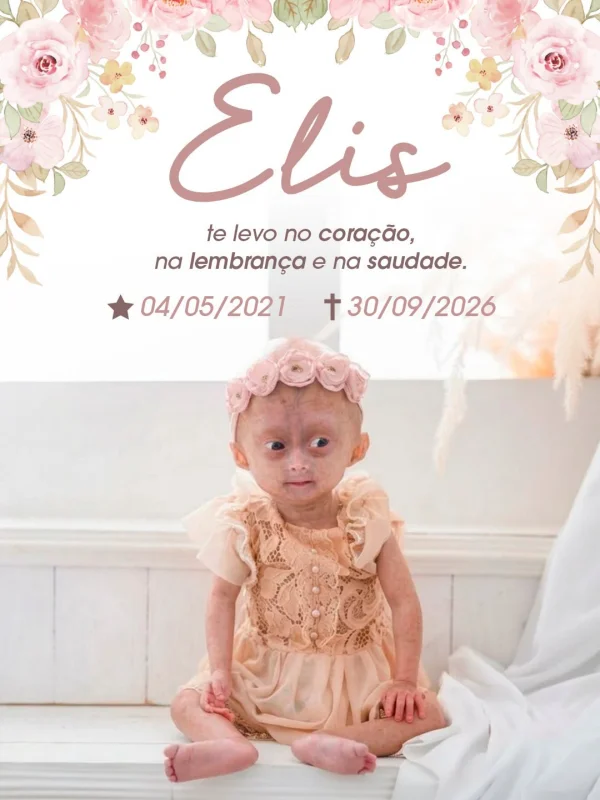 Mãe de Elis, influencer mirim com síndrome rara, lamenta morte. Veja - destaque galeria Mãe de Elis, influencer mirim com síndrome rara, lamenta morte. Veja - destaque galeria
