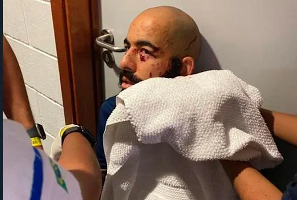 Como ficou o rosto do goleiro do Bahia atingido pela bomba