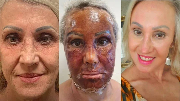 Foto colorida de mulher com maquiagem