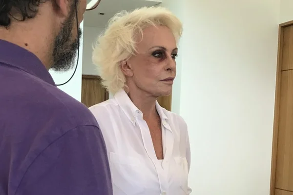 Ana Maria Braga é vista com olho roxo e preocupa a web