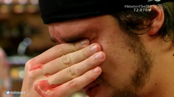 Masterchef: Victor B se fere gravemente e é impedido de fazer prova