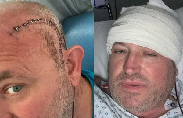 Homem com infecção de ouvido é internado e descobre câncer terminal