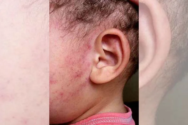 Pai agride o filho de 2 anos com chinelada no rosto e é preso