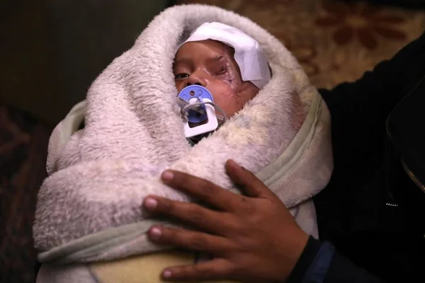Foto de bebê sírio que perdeu um olho motiva campanha de solidariedade
