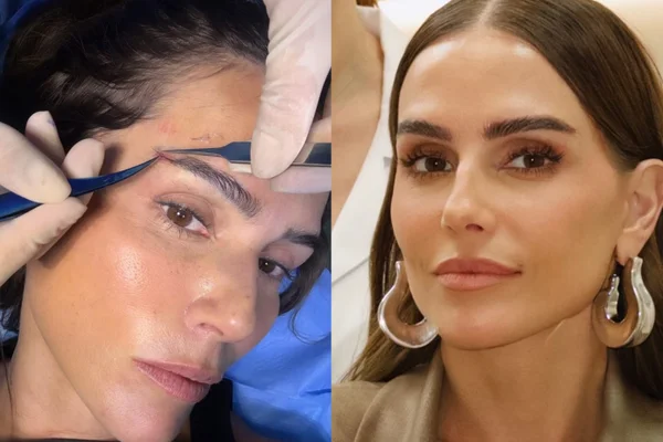 Deborah Secco transplante sobrancelhas