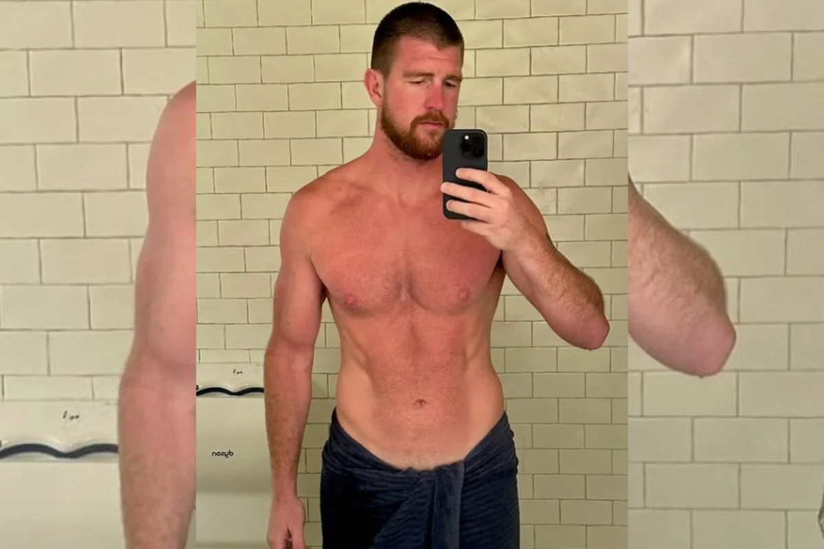 Kieran diz ser tratado como um "objeto sexual" por mulheres por causa do tamanho do seu pênis, de 25 centímetros Kieran diz ser tratado como um "objeto sexual" por mulheres por causa do tamanho do seu pênis, de 25 centímetros