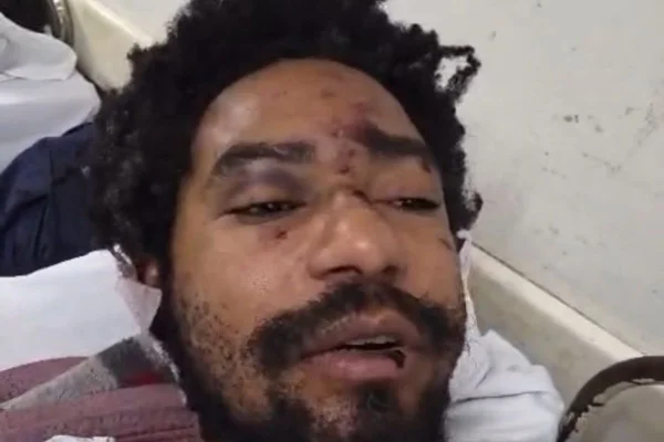 Imagem colorida de Diego Souza Moreira, ator vítima de ataque homofóbico em adega em São Paulo