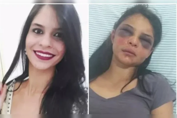 Mulher fica com rosto desfigurado após apanhar e ficar 36h amarrada