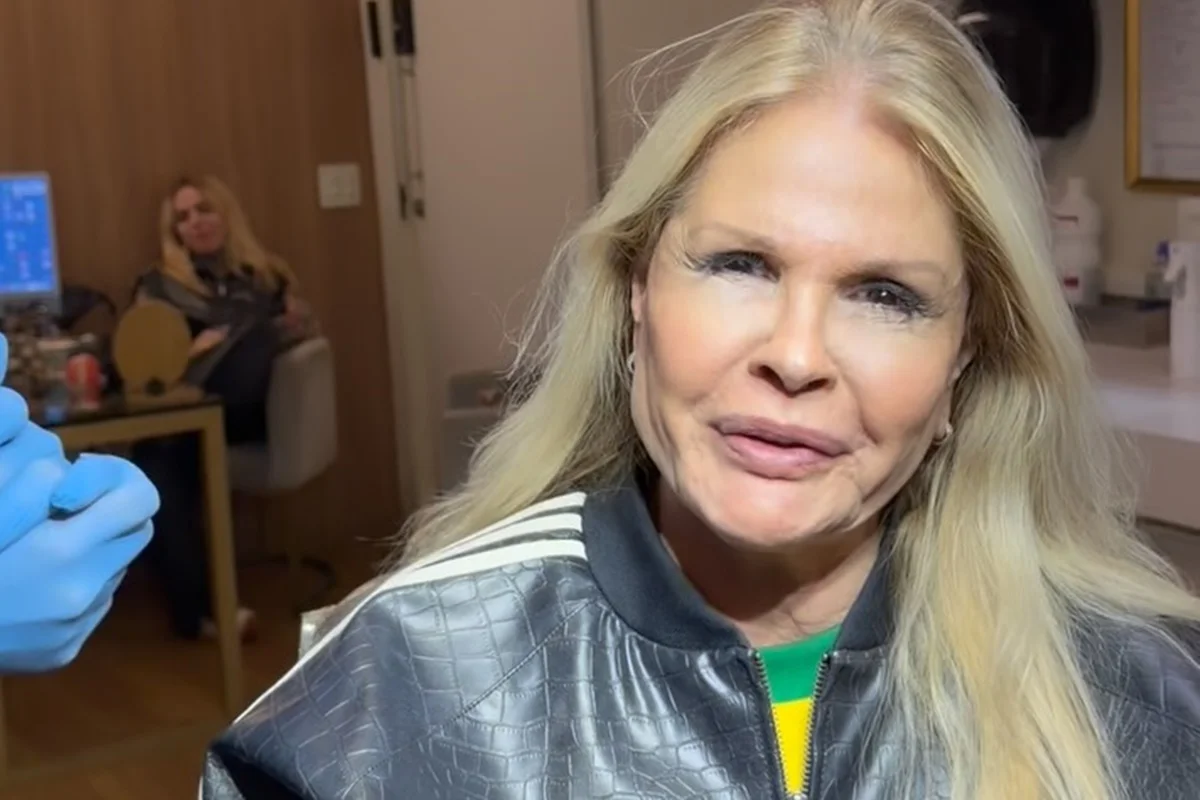 Monique Evans se divertiu ao contar o problema que teve após o procedimento Monique Evans se divertiu ao contar o problema que teve após o procedimento