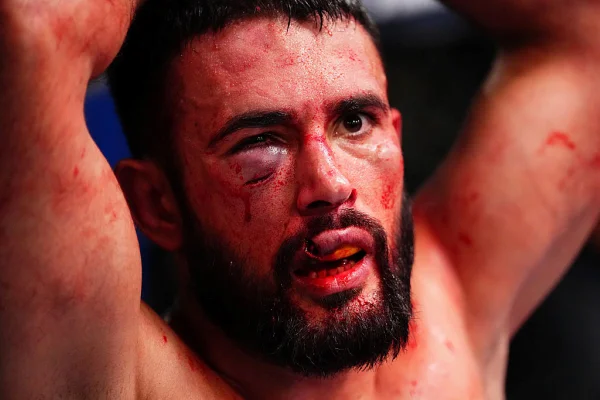 Imagem colorida de lutador do UFC que teve boca rasgada em luta- Metrópoles