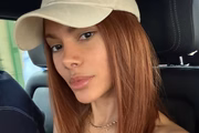 Anitta surpreendeu os fãs com o resultado dos procedimentos que realizou