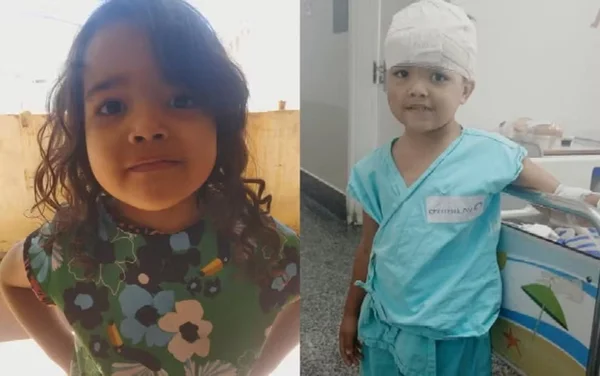 imagem colorida menina atacada pitbull goiania