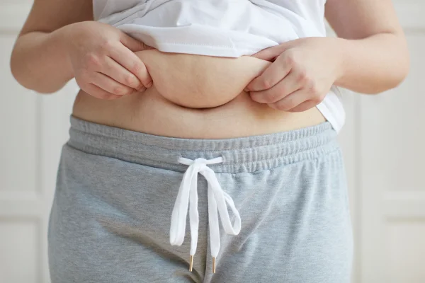 Foto colorida de crpor feminina evidenciando a gordura abdominal - Metrópoles.