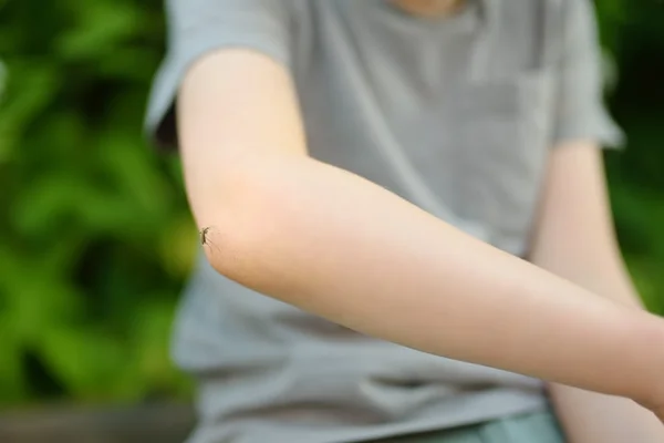 Mosquito picando o braço de criança., dengue infantil - Metrópoles