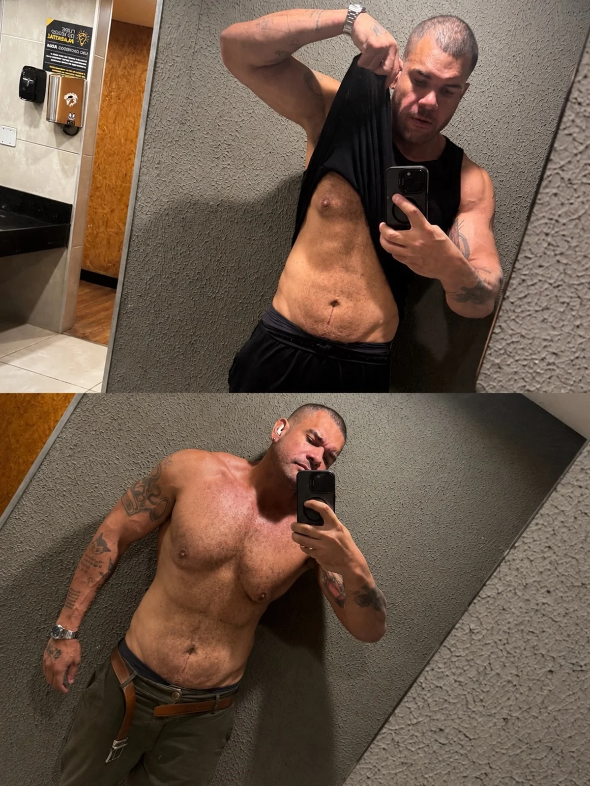 Diego Menasse apresentou complicações após passar por uma cirurgia Diego Menasse apresentou complicações após passar por uma cirurgia