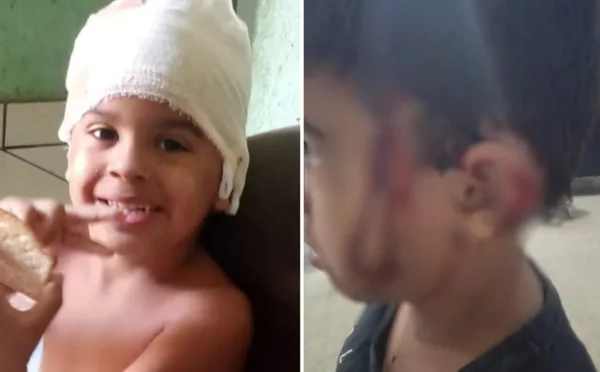 Menino perde parte da orelha ao ser atacado por cachorra enquanto passeava com a mãe, em Aparecida de Goiânia, Goiás