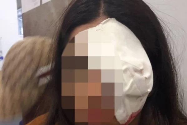 SP: jovem fica cega ao ser baleada por PM em baile funk, diz mãe