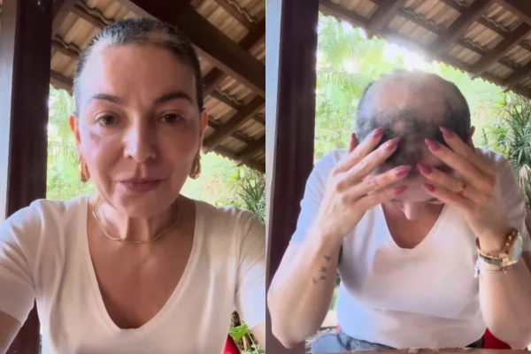 Mãe de Lucas Lucco desabafa ao anunciar a volta da alopecia areata