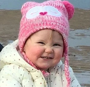 Grávida acreditava esperar gêmeos, mas bebê nasce com duas cabeças