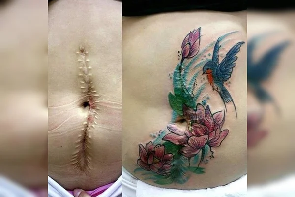 Projeto A Pele da Flor