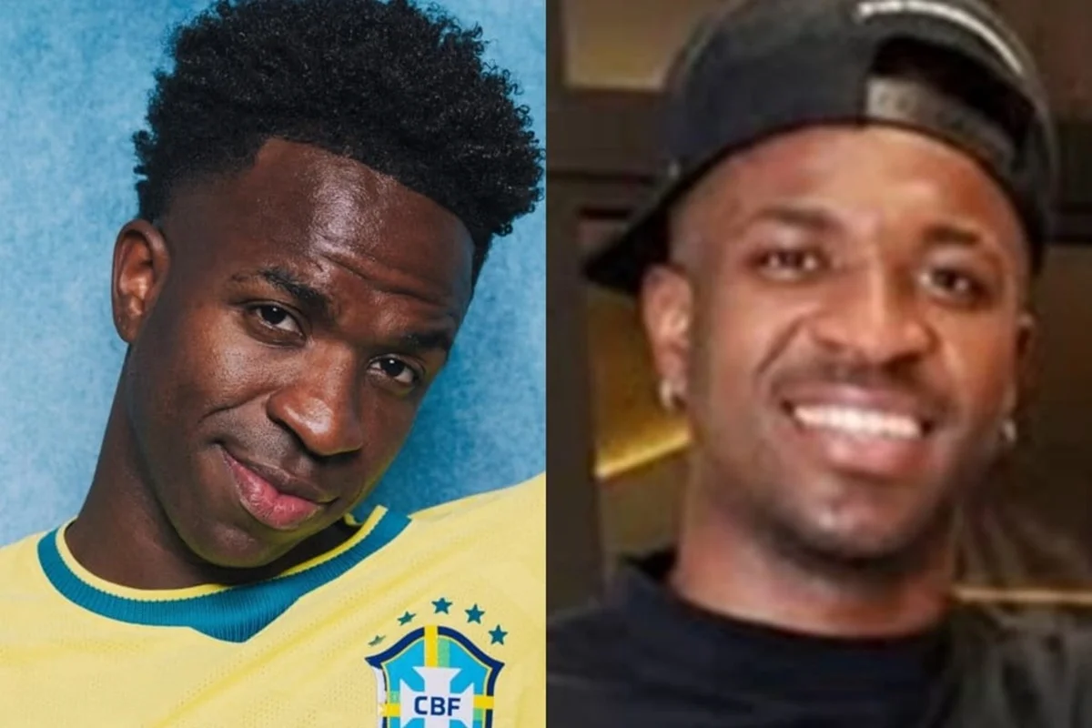 Vini Jr.: harmonização melhora rosto, mas não a respiração pela boca Vini Jr.: harmonização melhora rosto, mas não a respiração pela boca