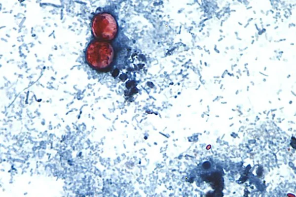 Foto microscópica de parasita capaz de contamitar alimentos frescos - Metrópoles.
