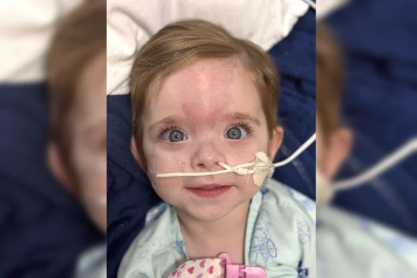 Bebê Aurora durante tratamento da síndrome genética