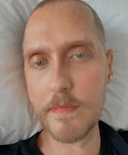 Luiz registrou ganho de peso no hospital, onde ele chegou a pesar menos de 40 quilos