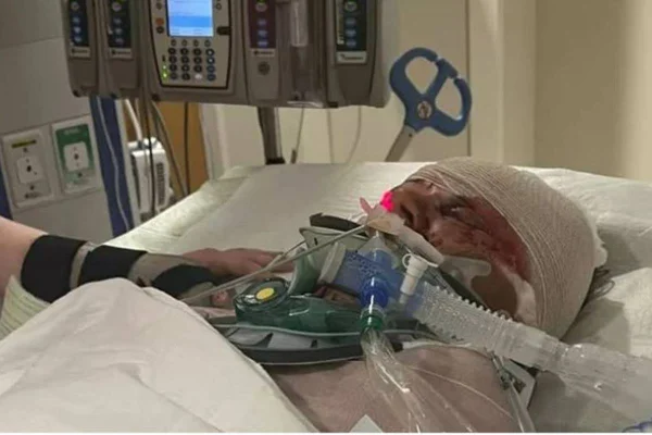 Mulher hospitalizada após ataque de cachorros