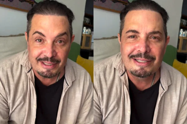 Conrado faz harmonização facial e muda o visual; veja o antes e depois
