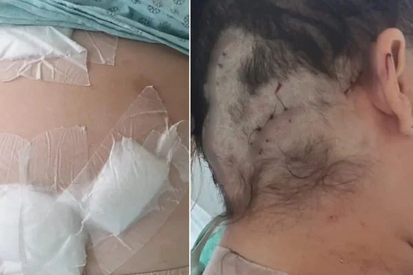 Imagem colorida, Mulher teve ferimentos na cabeça- Metrópoles