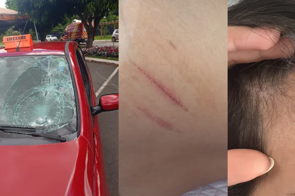 Jovem atropelada em exame de CNH desabafa: “Pensei que não ia escapar”