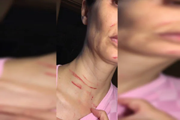 Enfermeira é agredida dentro de hospital público do DF