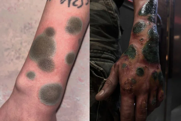 Tatuagem em forma de mofo