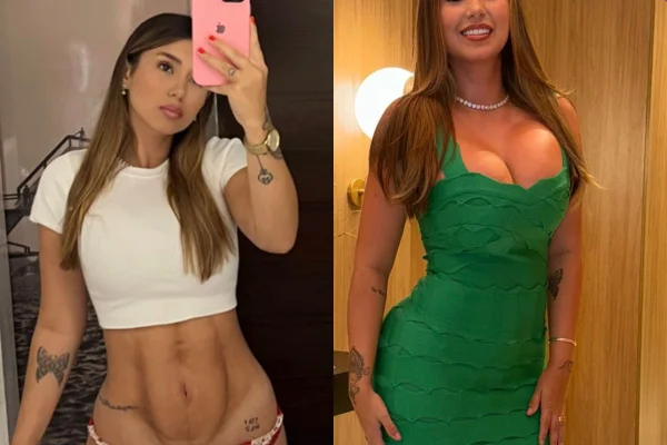 Nas redes, a influenciadora Mariana Tavares disse que “serviu de cobaia” para a Clínica JK Estética. Ela passou por 3 cirurgias em 3 anos - Metrópoles