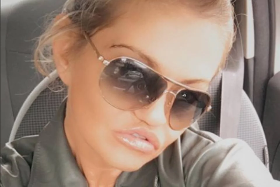 Atriz que teve rosto corroído por cocaína aparece irreconhecível. Veja - imagem 3 Atriz que teve rosto corroído por cocaína aparece irreconhecível. Veja - imagem 3