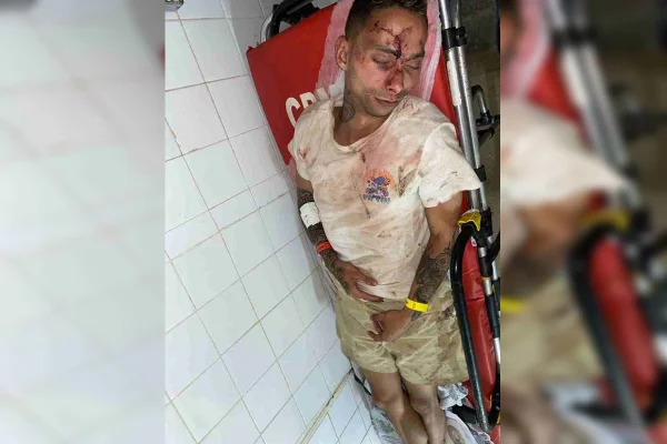 Imagemm colorida de homem agredido