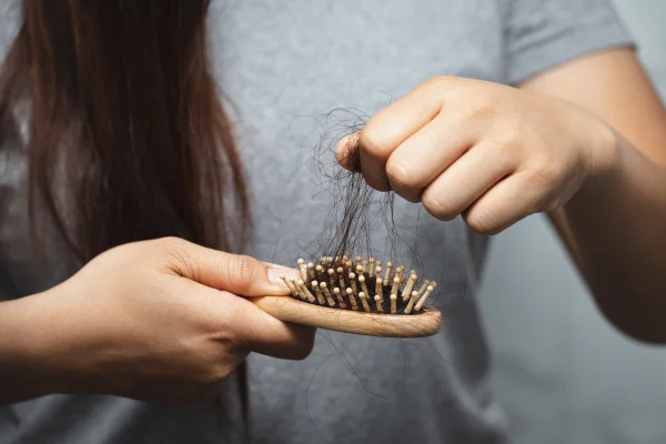 Queda de cabelo