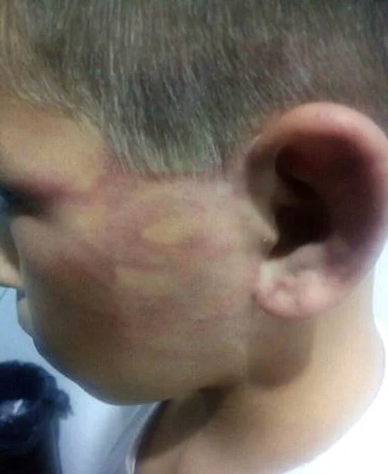 Pai é detido por agredir filho com correntes e pá em MT