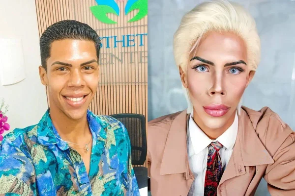 Conhecido por sua customização como “Ken Humano”, Felipe Máximo tenta nova vida como frentista em São Paulo. Influenciador morava em Peruíbe - Metrópoles