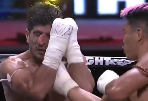 Imagem colorida de lutador com o nariz quebrado