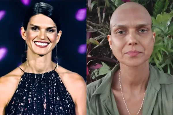 Montagem de fotos coloridas de Karina Zeviane. Antes e depois da quimioterapia - Metrópoles