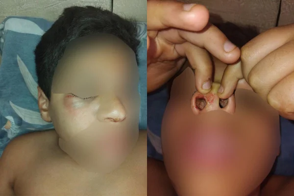 Após filho de 11 anos ser agredido na escola por causa da exposição de Marçal, mãe lamenta a situação - Metrópoles