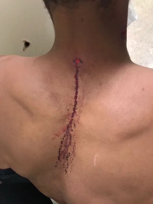 Nasceu de novo: no DF, homem leva tiro na nuca e sobrevive; veja fotos