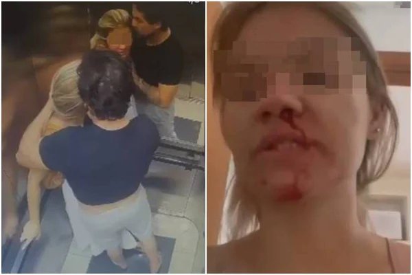 Após agredir jornalista e limpar rosto ensanguentado, namorado a beija